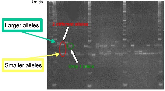 electrophoresis